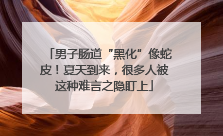 男子肠道“黑化”像蛇皮！夏天到来，很多人被这种难言之隐盯上