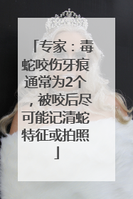专家：毒蛇咬伤牙痕通常为2个，被咬后尽可能记清蛇特征或拍照